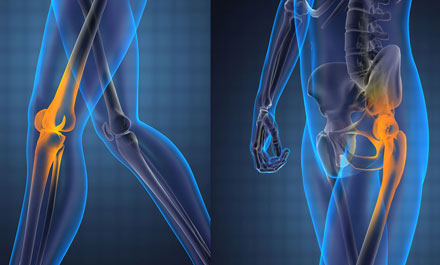 Hip and Knee Replacement