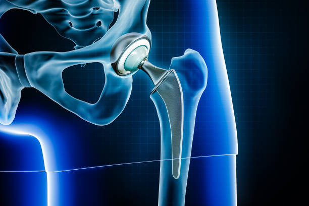 Doctor for Hip Replacement in Kalyan