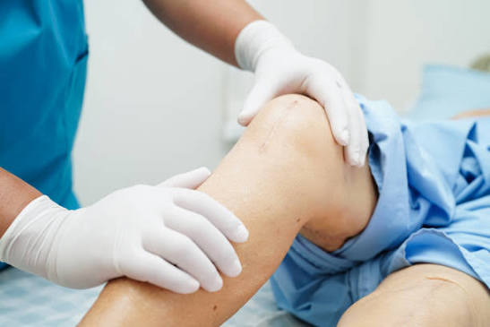 Knee Replacement Surgeon in Kalyan