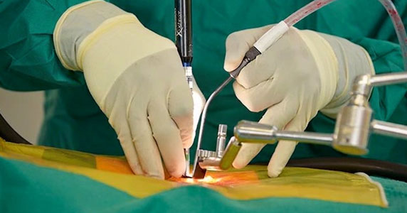Minimally Invasive Spine Surgery