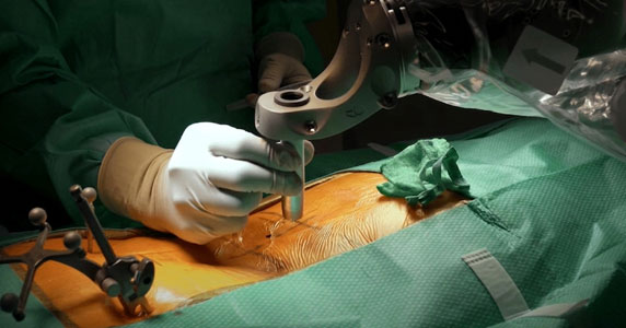 Robotic Spine Surgery